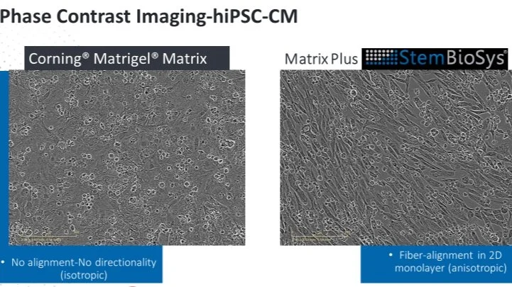 Free Webinar: High Throughput Cardiotoxicity Screening Using Mature hiPSC-Cardiomyocytes (hiPSC-CMs)