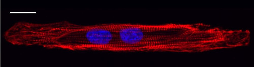 StemBioSys Announces Launch of CELLvo™ Atrial Cardiomyocytes, a  Technological Leap Forward in Cardiotoxicity Screening