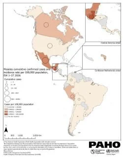 Measles Surging Worldwide, Thanks to Vaccine Hesitancy