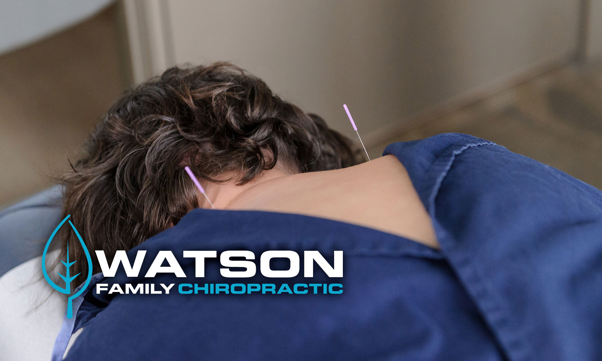  Acupuncture patient at Watson Family Chiropratic 