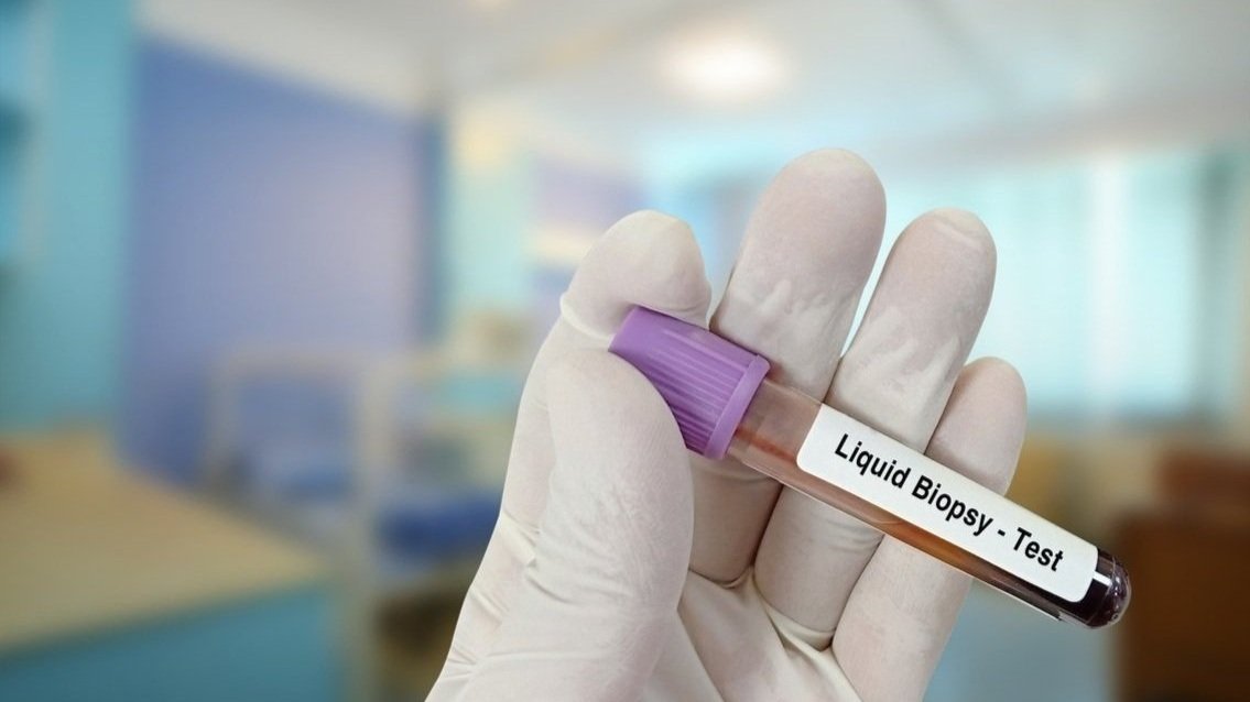 LIQUID BIOPSY TESTING FOR CANCER