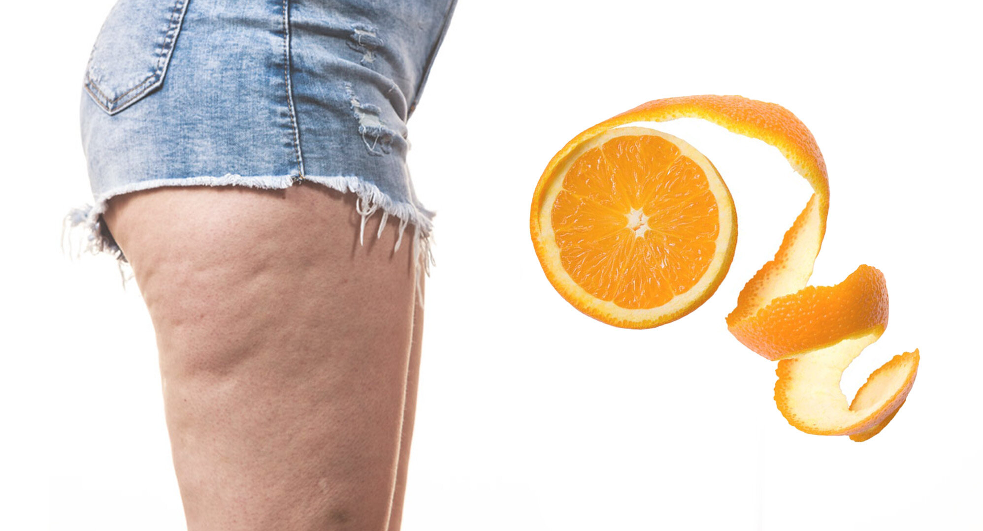 La Cellulite c’è e si vede…come curarla? — Fiori di Cipria