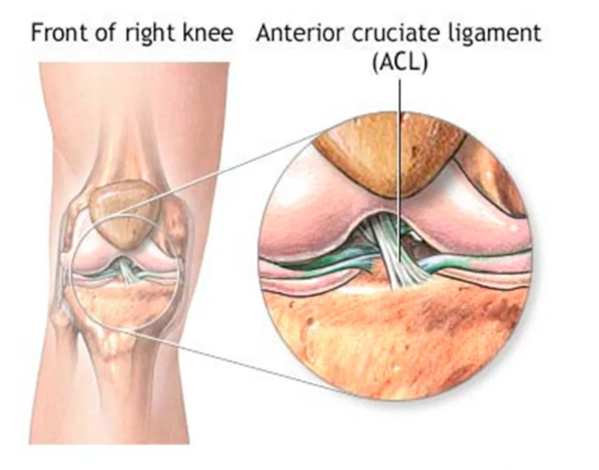 Image courtesy kneeandshoulderclinic.com.au