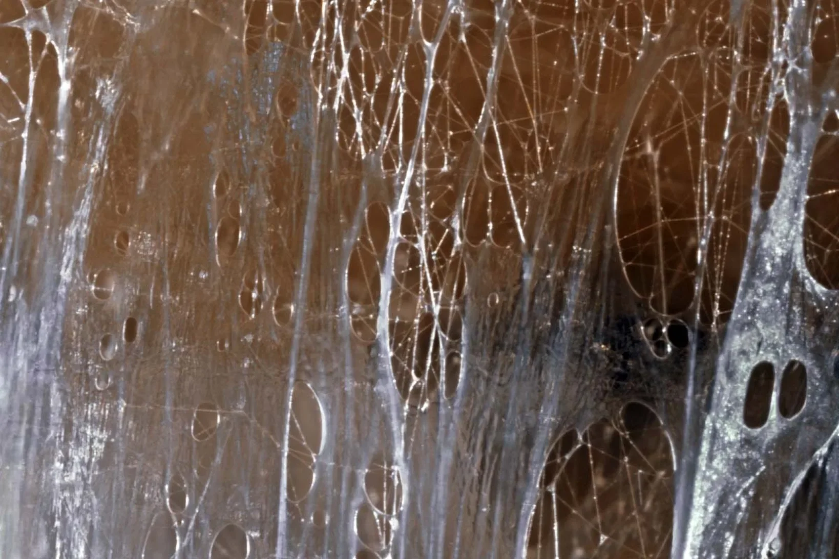 The Truth About Fascia: Can You Really Break It Up?