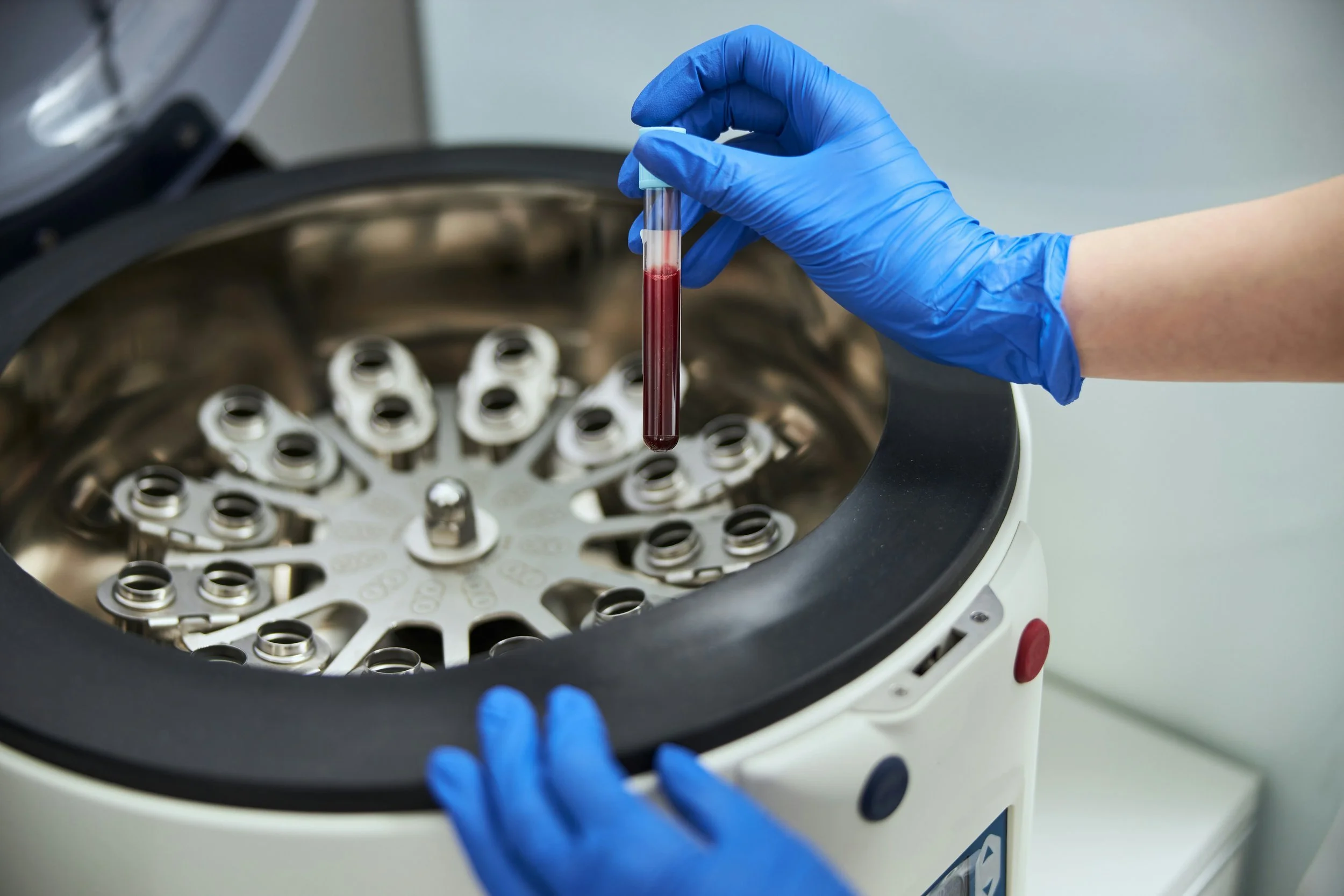 PRP Injections in Rehabilitation: What You Need to Know
