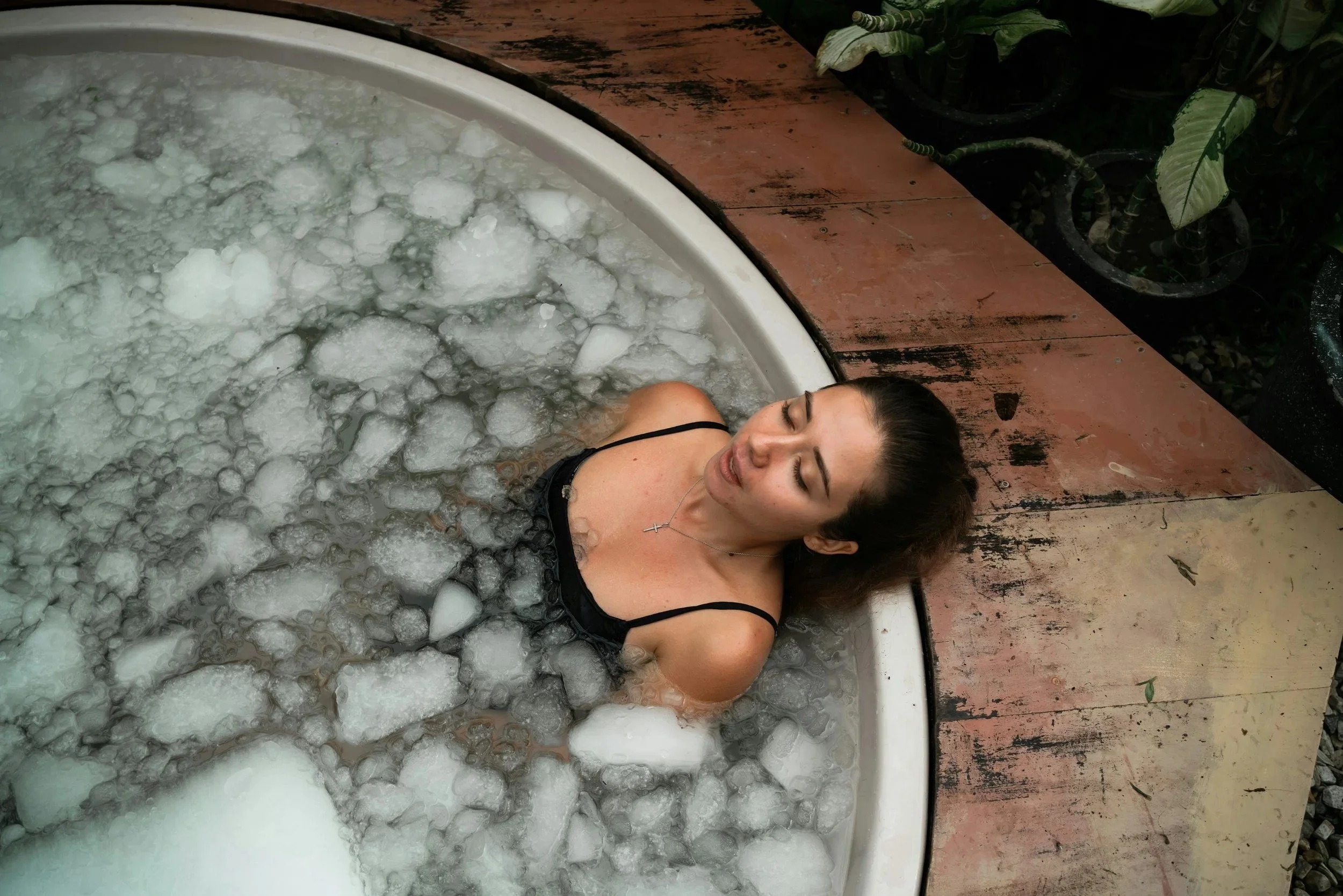 Cryotherapy: When Should You Use Ice on an Injury?