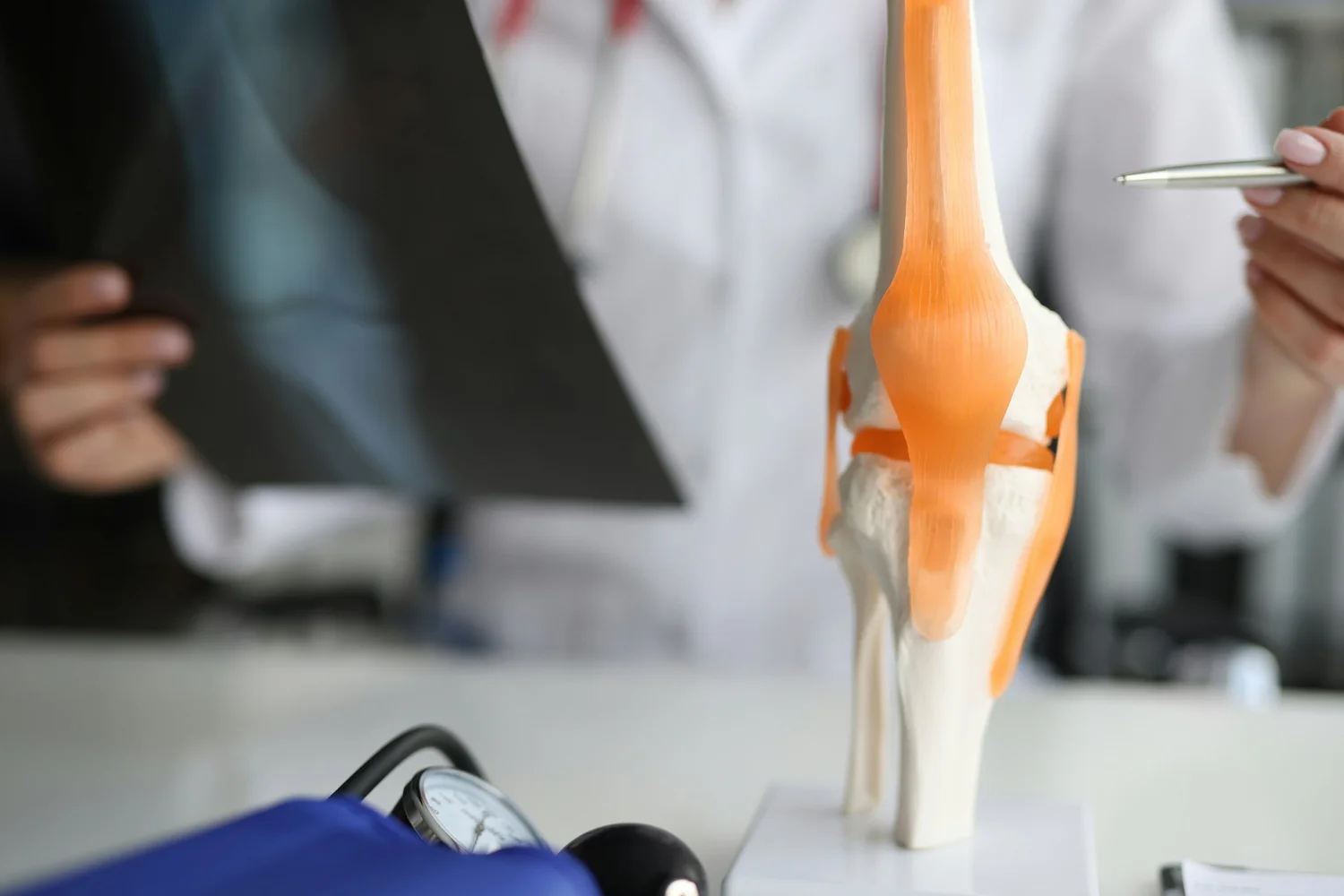 A clinician holds up a knee X-ray next to an anatomical model of the knee joint.