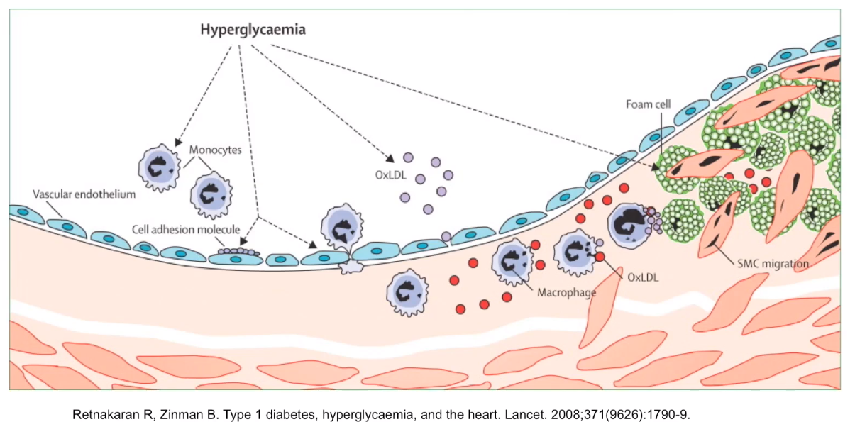 atherosclerosis.png