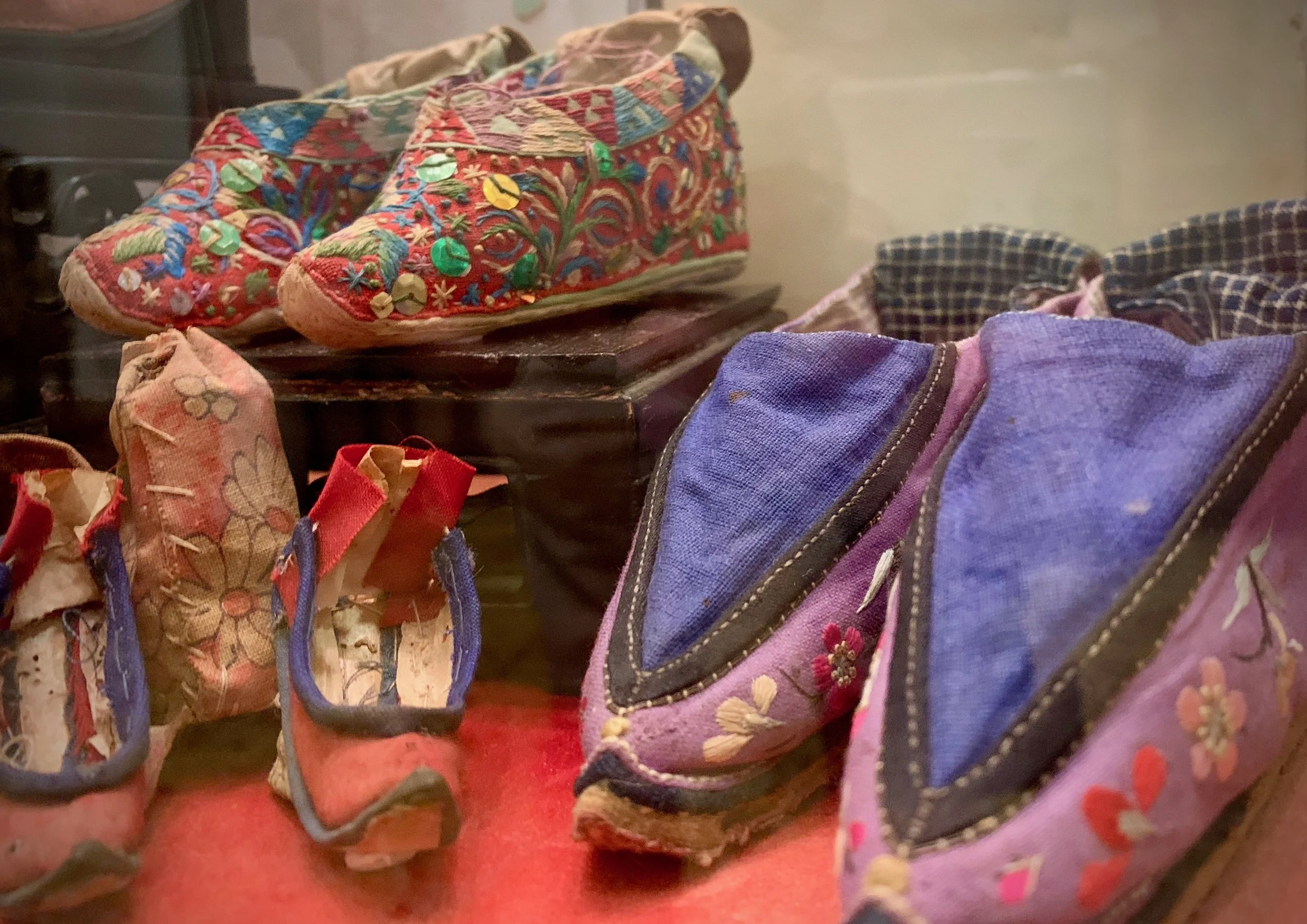 Traditional Chinese foot binding began in infancy. The ideal adult foot would fit into the palm of your hand. As feet continued to grow, bones were removed to ensure the foot would fit into the shoe. Many children died during this process from infection.