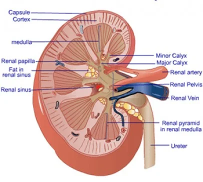 Jiggered Kidney Transplant