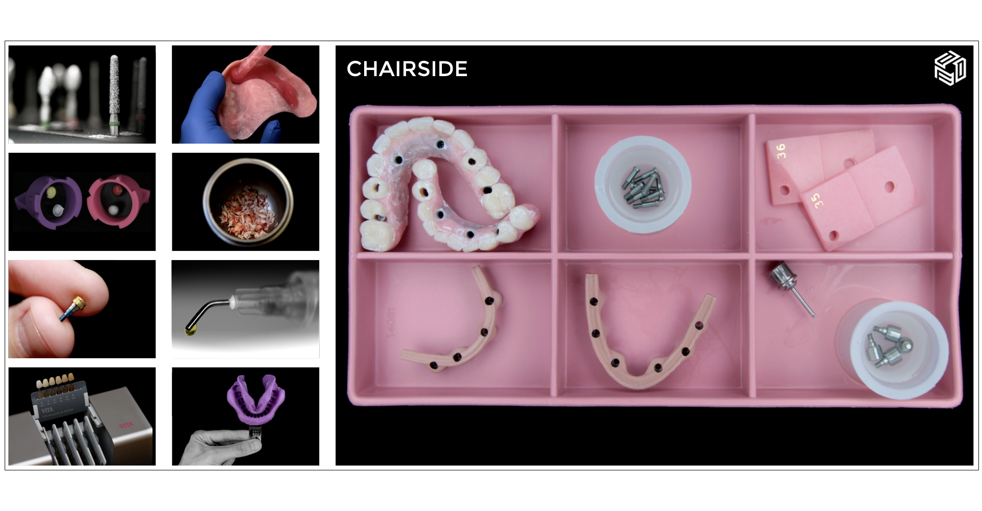 CHAIRSIDE UPDATE.001.png