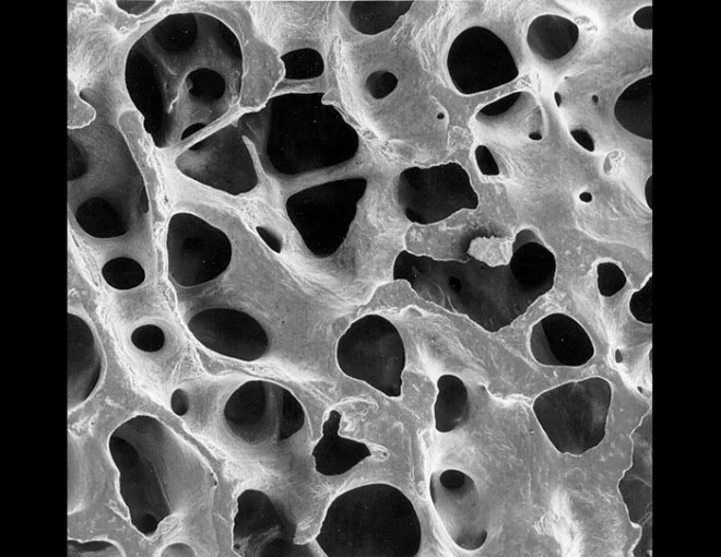 bone-sem-e1443252423114.jpg