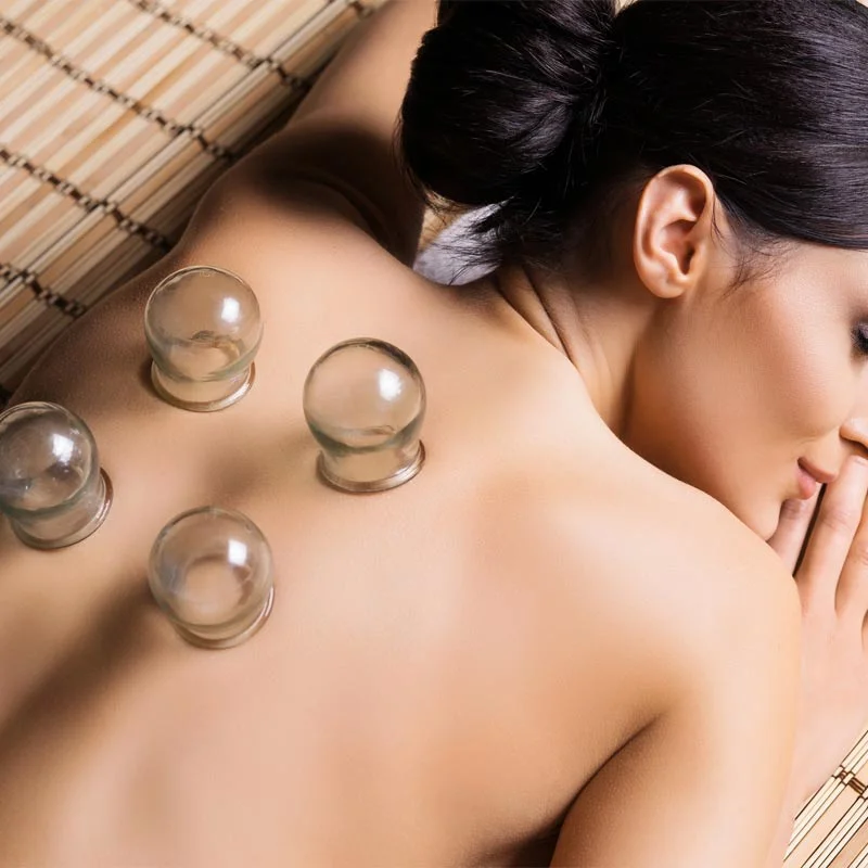 cupping-1.jpg