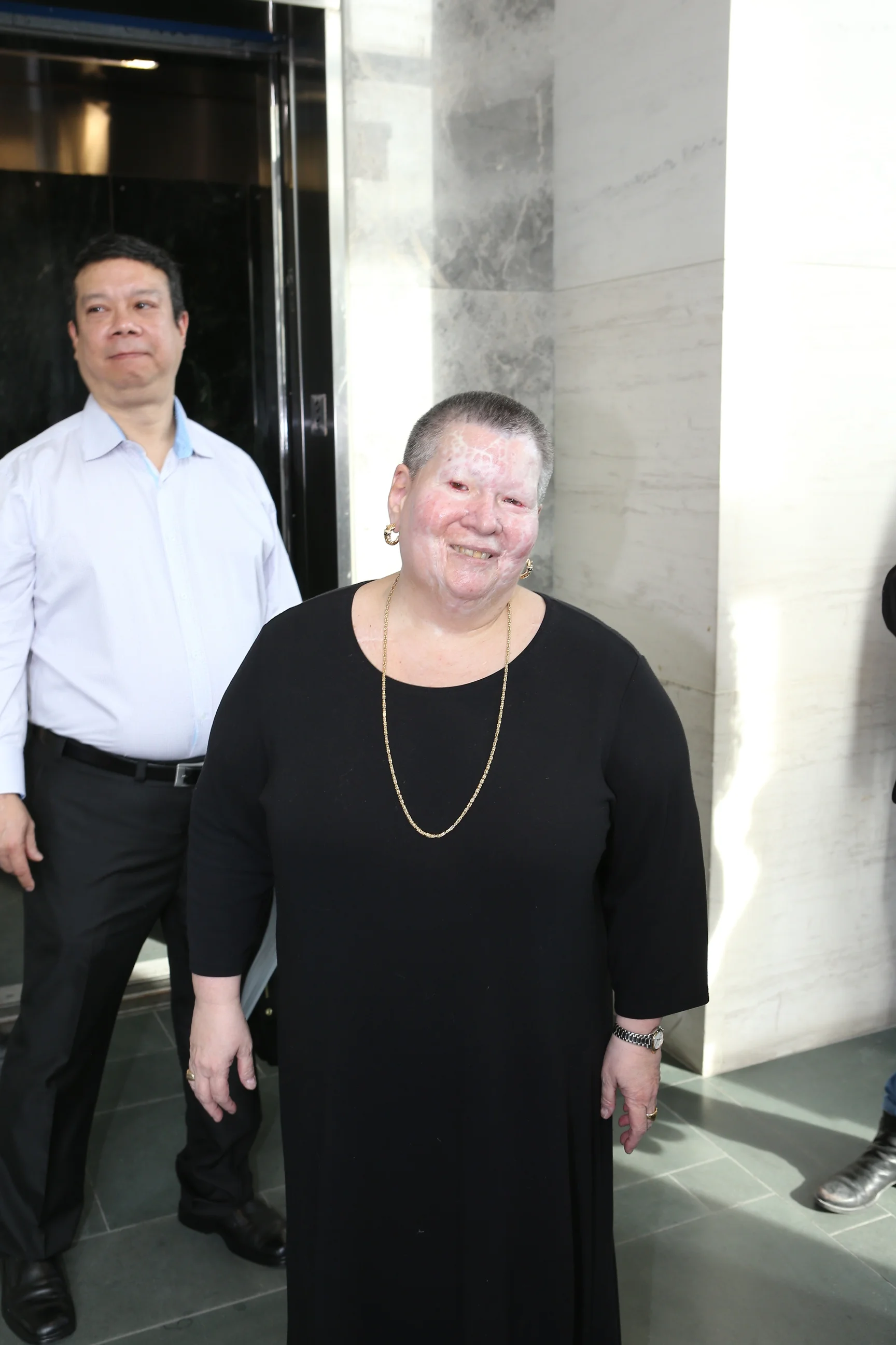 Alexandra Dyer speaks to reporters outside Queens Supreme Court after Kim Williams, the mastermind of the acid attack that left Dyer permanently scarred, was sentenced to 17 years in prison. Pool photo by Ellis Kaplan