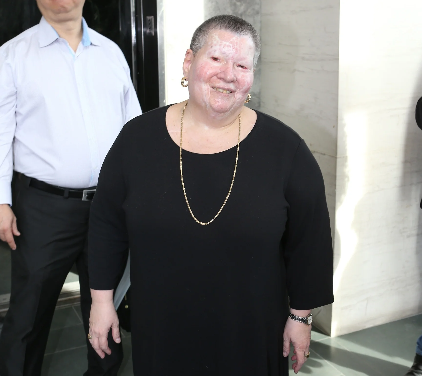 Acid Attacker Sentenced to 17 Years in Prison