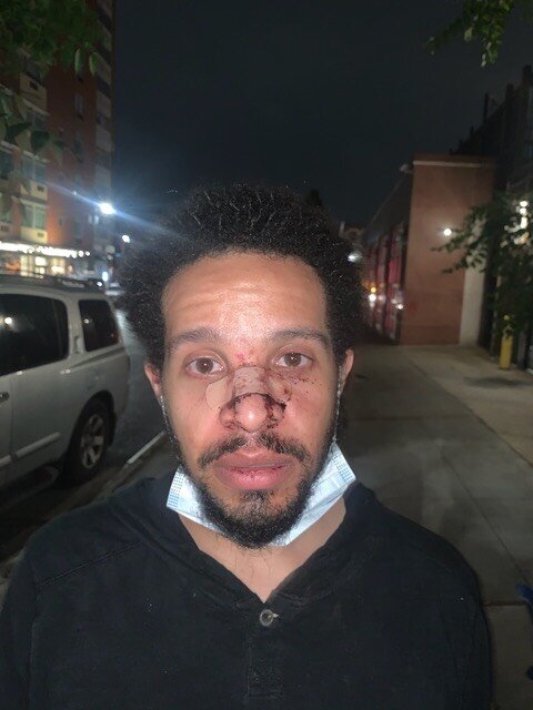 Civil rights groups sue NYPD for brutality during George Floyd protests