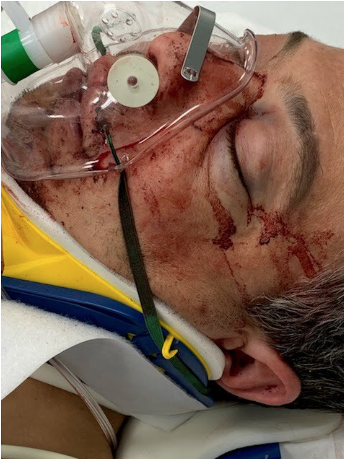 Savage attack on Muslim family in Rego Park sparks call for hate crime probe
