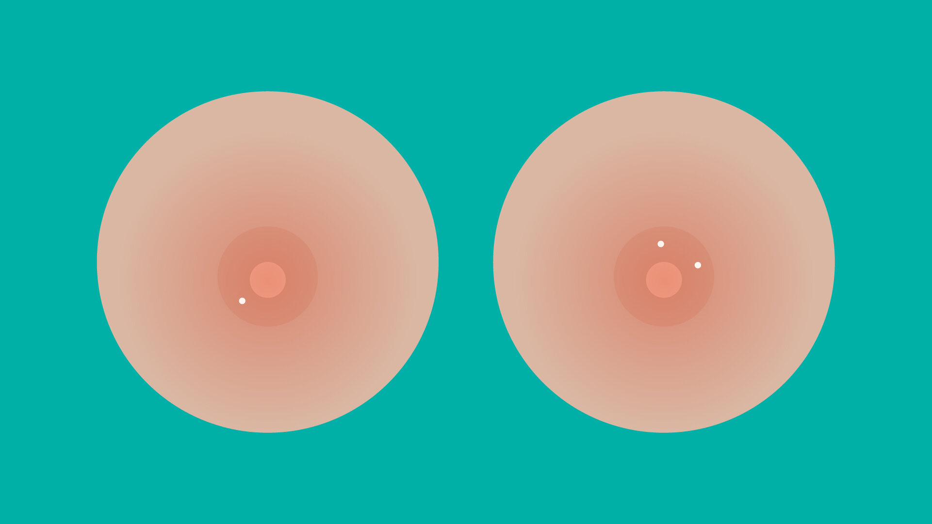 Mamava - Chafed and tender nipples are a common problem