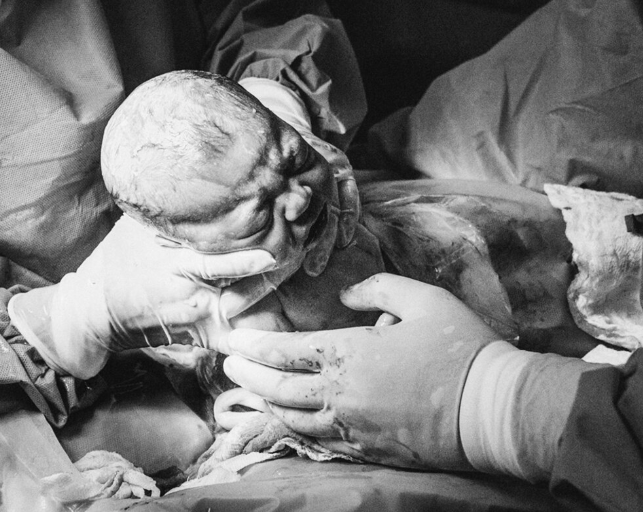 Birth Photography : c-section ~ R4950