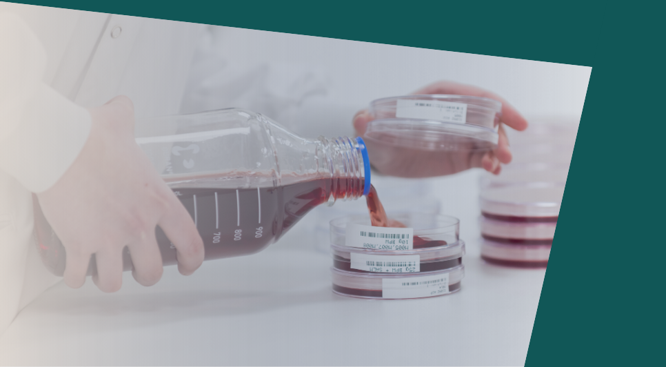Microbiology Food Testing Lab | Shelf Life Testing| Listeria — Normec ...