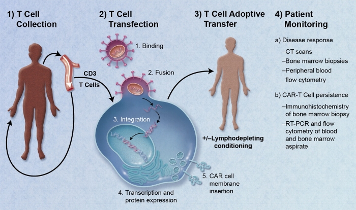 CAR-Engineered_T-Cell_Adoptive_Transfer.jpg