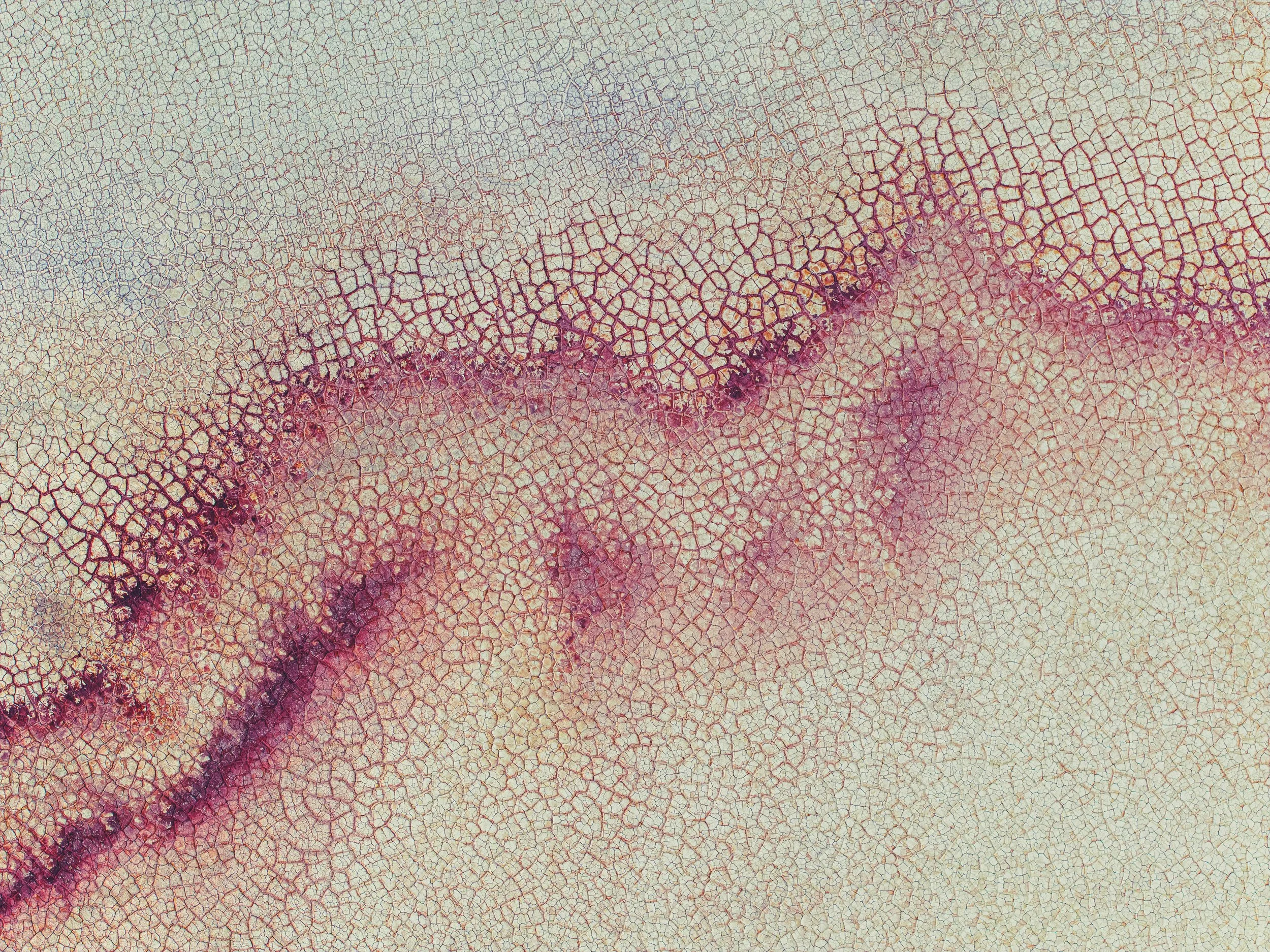 Types of Inflammatory Skin Conditions and Interventions You Should Try