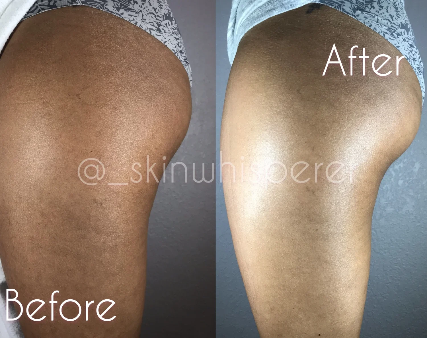 body contouring New Braunfels