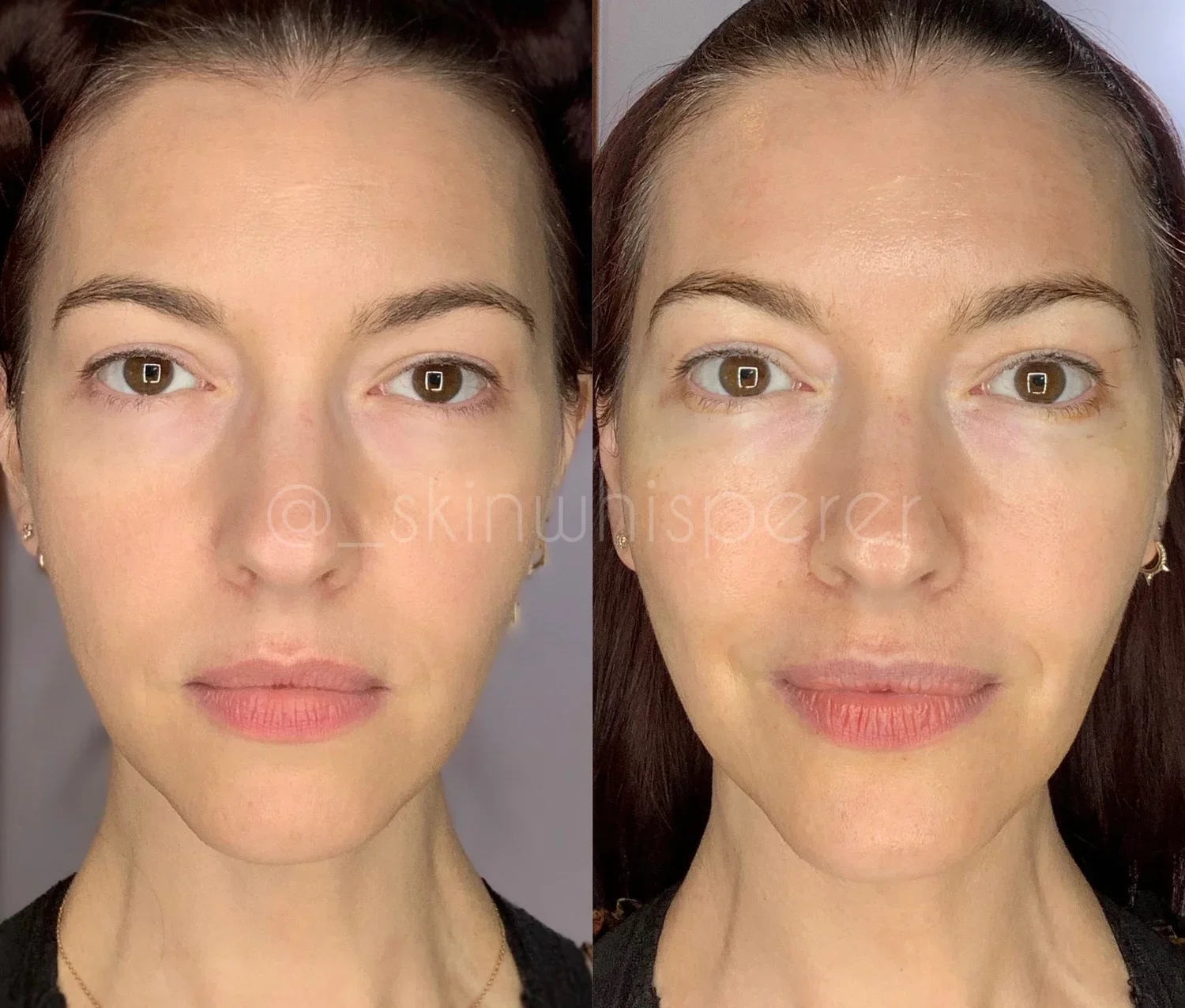 holistic facial treatment in New Braunfels TX