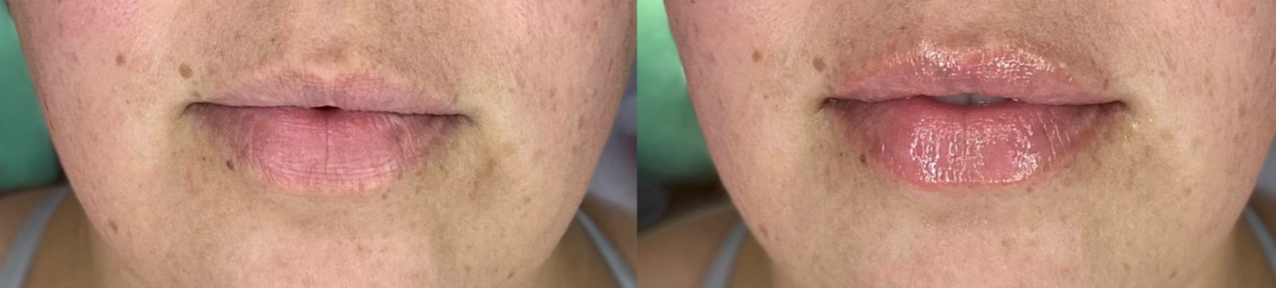 Holistic Facials in New Braunfels
