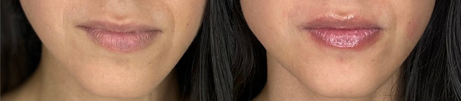 Holistic Facials in New Braunfels