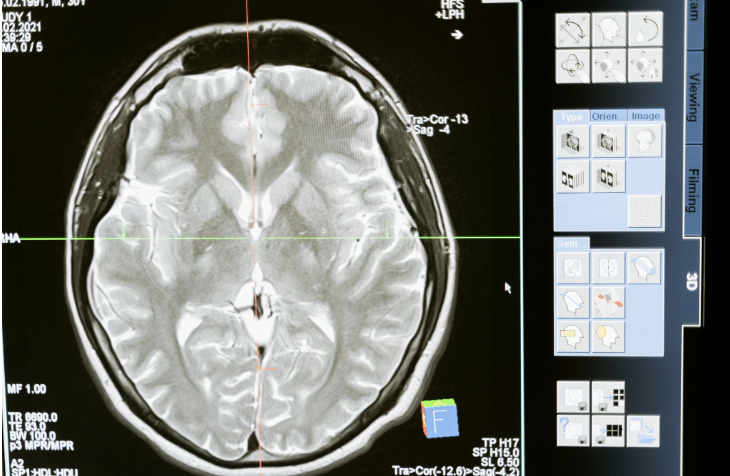 How YOUR daily habits may eventually destroy your cognition and consciousness – and why neurology tips work