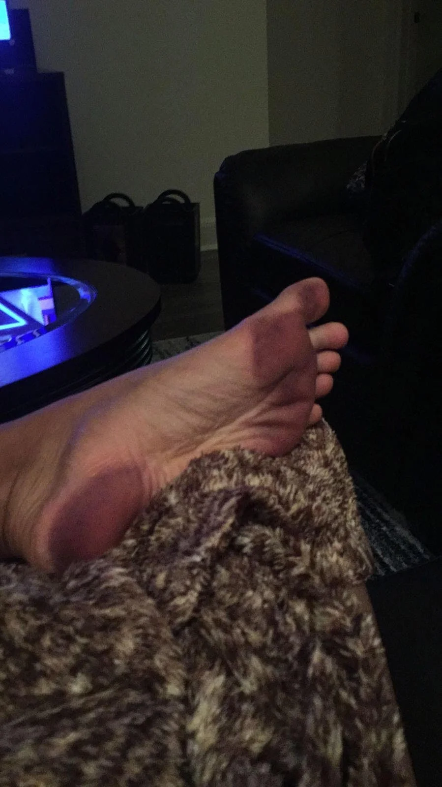  I cant remember whose foot this was, but it was a direct result of mehndi night 