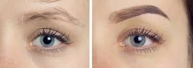 eye2.jpg