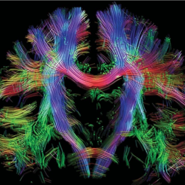 Naoki Hashimoto, former brainLENS UCSF staff, was just published in Psychiatry and Clinical Neurosciences