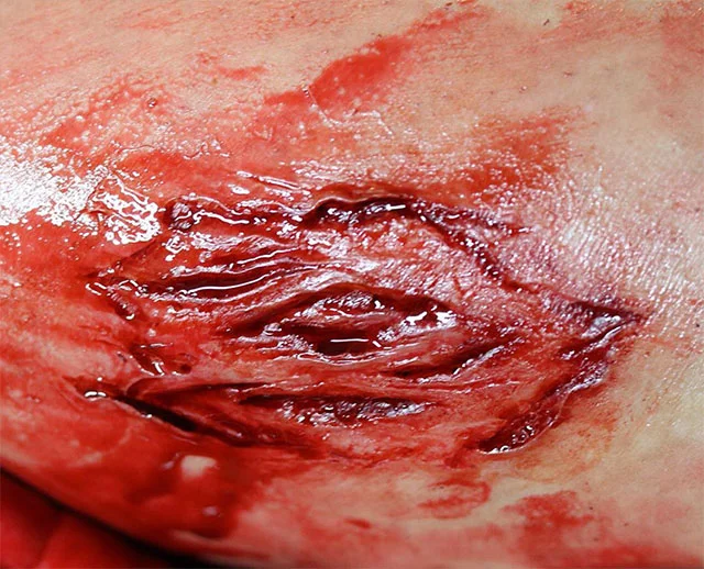 thigh gash resized.jpg