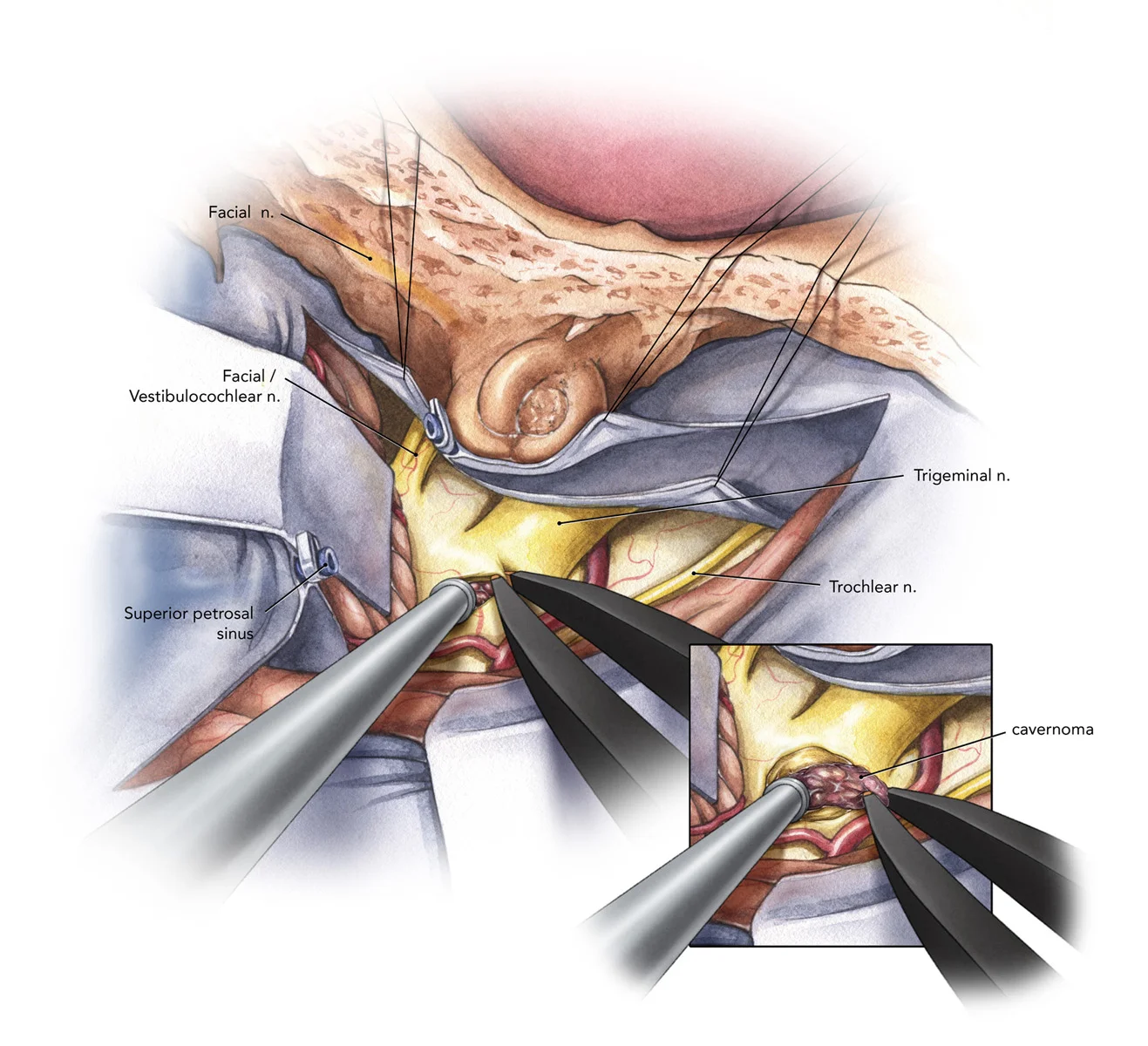 82_06Surgical.jpg