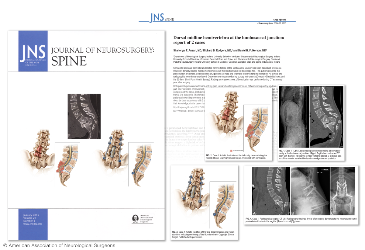 JNS-Spine.png