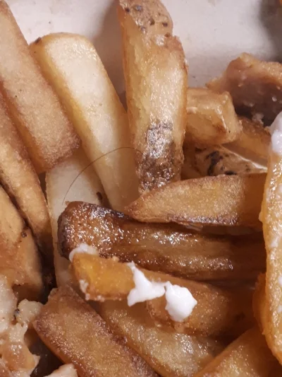 Hair found in the shawarma-poutine at Rex’s Den. ALI JAVEED/THE UNDERGROUND