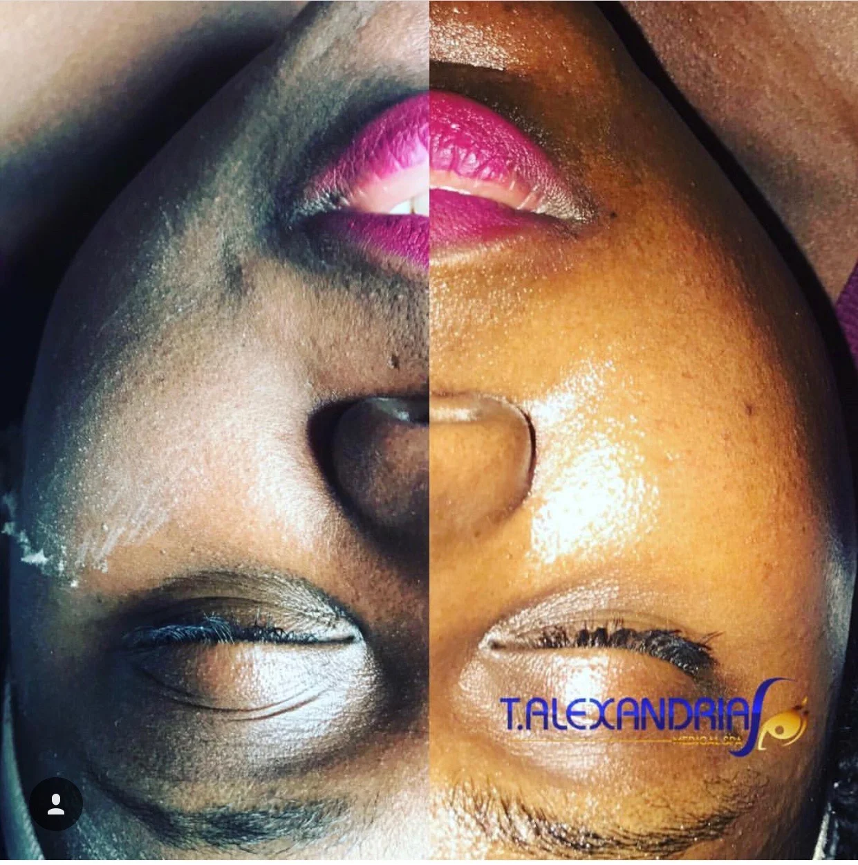 Let Us Help You Treat Your Skin!!  Schedule a FREE Consultation today and receive 20% off your first facial appointment.