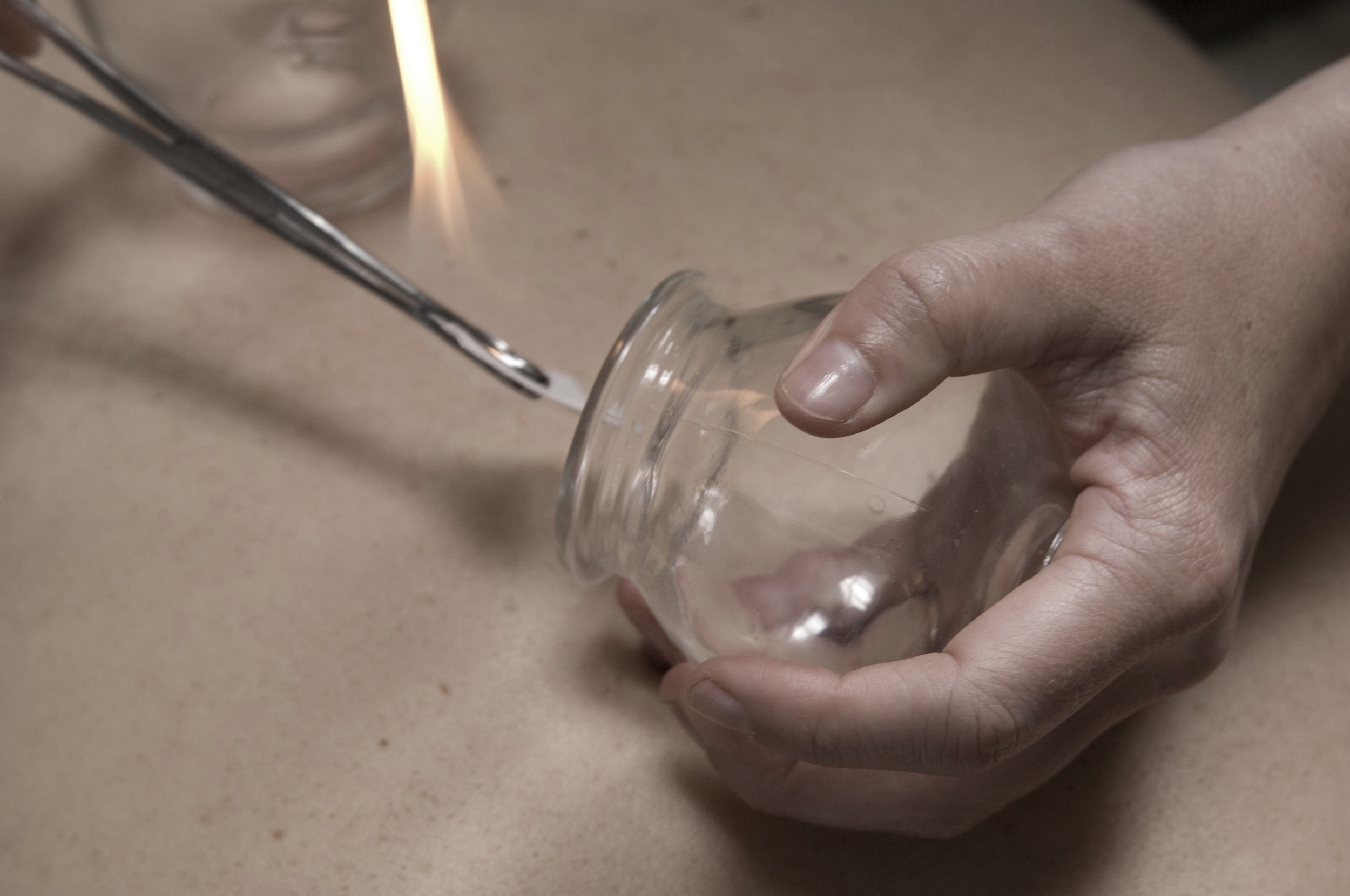 Fire Cupping Therapy 