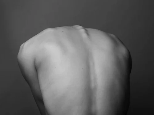 Body Dysmorphic Disorder (BDD): Why It’s Not Vanity