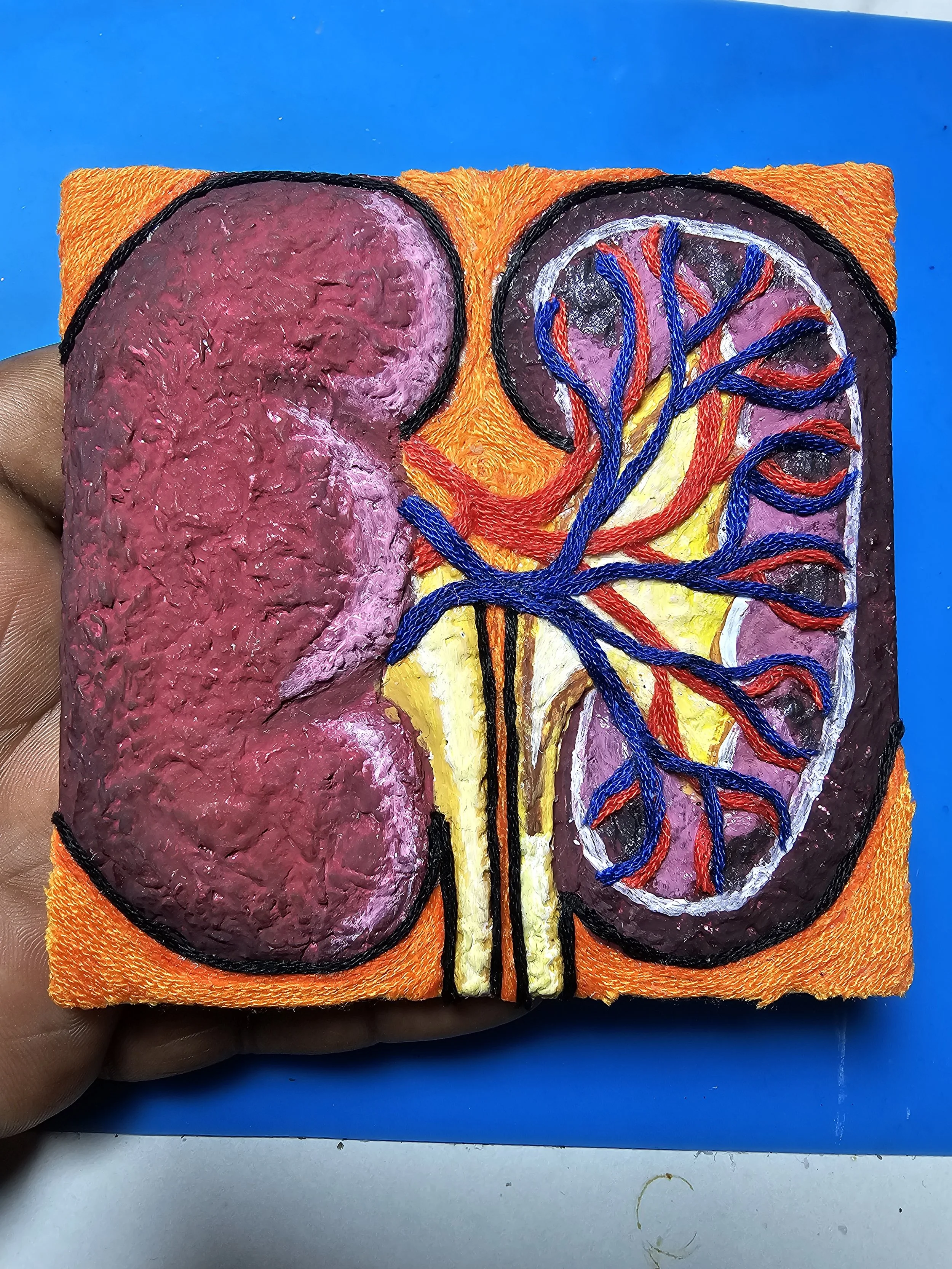A hand-painted artwork on a mini canvas of fabric depicts a stylized pair of human kidneys with one kidney showing a detailed vascular structure and the other kidney appearing solid and textured, with black outlines and vibrant colors.