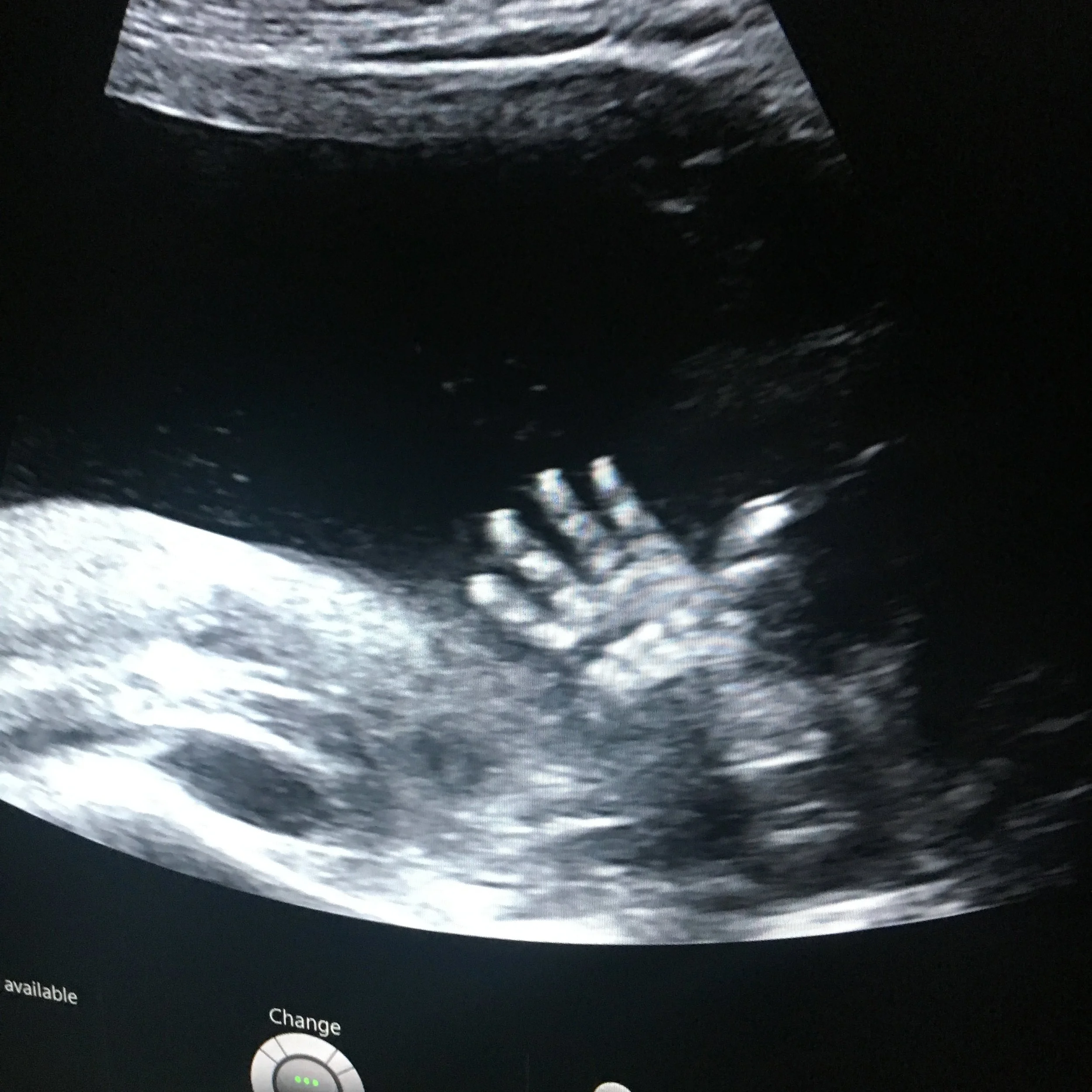 Maybe Baby #6: Our unconventional (Christmas) miracle