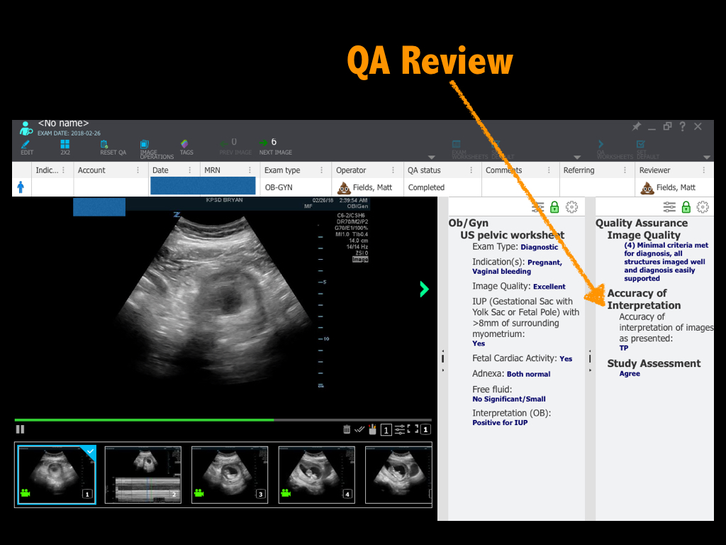You can see feedback in the Quality Assurance tab on the right.