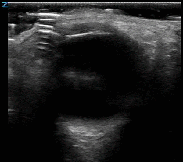 1.3.6.1.4.1.6052.9067618070.11556053173.15871258584223_crop.gif