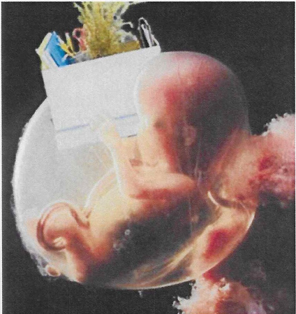 fetus.png
