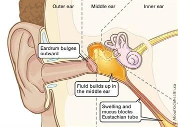 Image source: About Kids Health