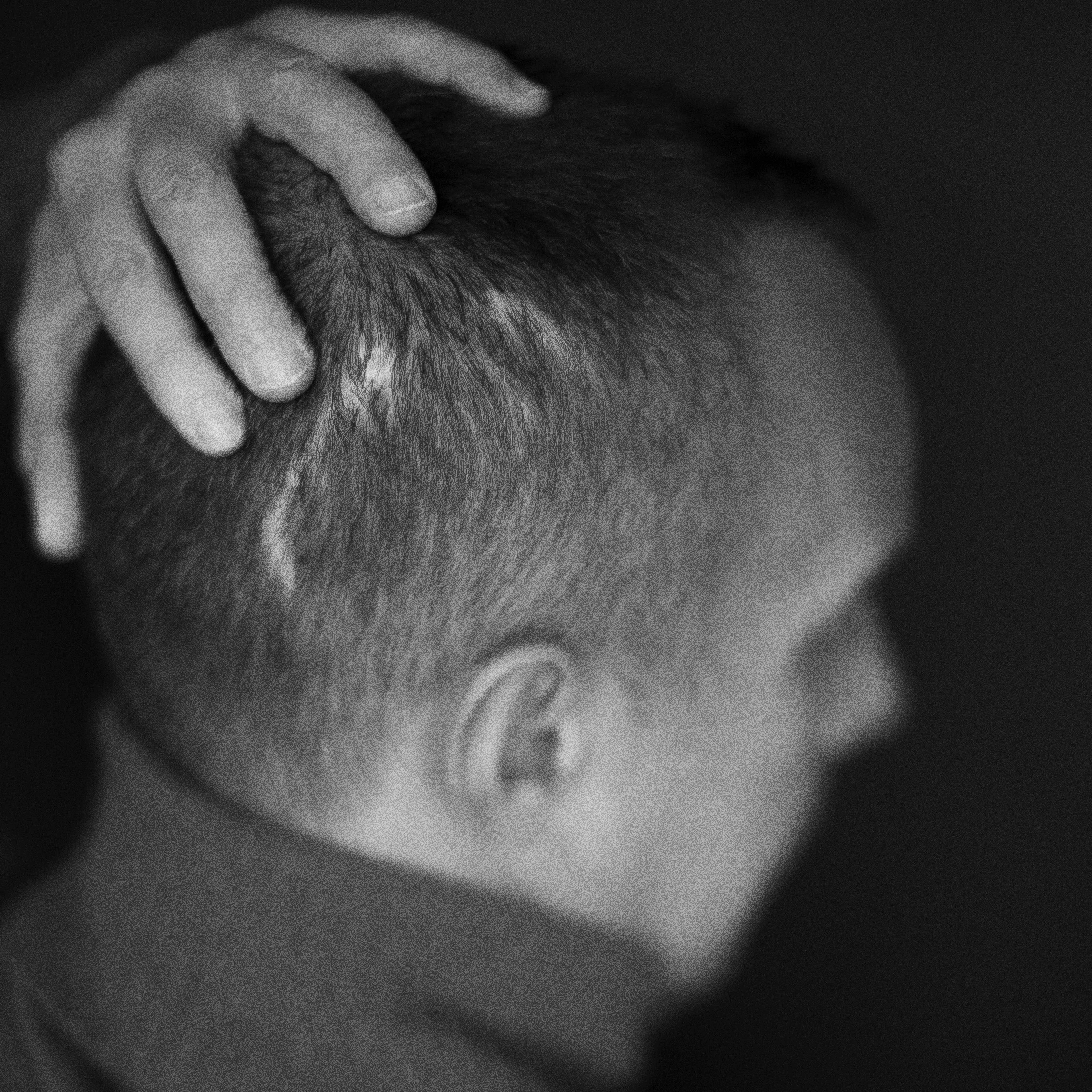PeteWilkins_081_scar.jpg
