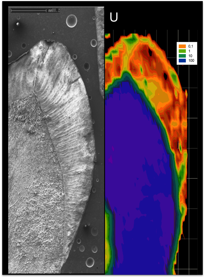 Mapping of teeth.png