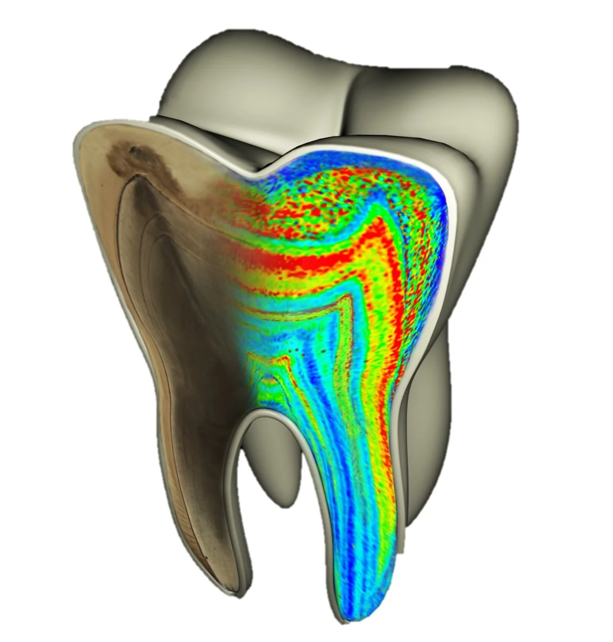 tooth.jpg